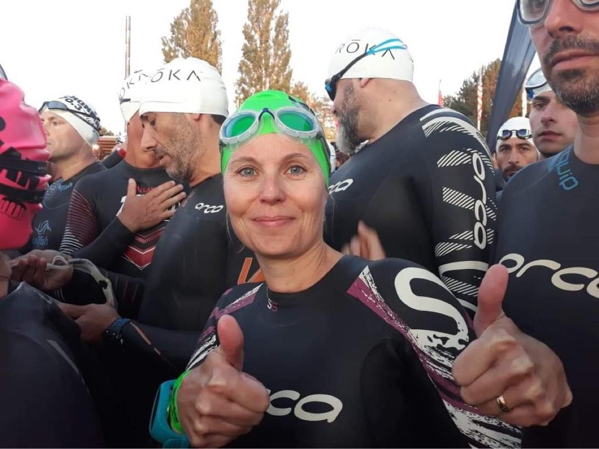 Naevus géant : association naevus 2000